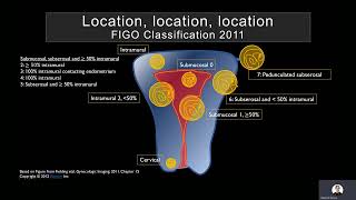 Ultrasound of the Myometrium by Mindy H Horrow MD FACR FSRU FAIUM [upl. by Sherwin962]