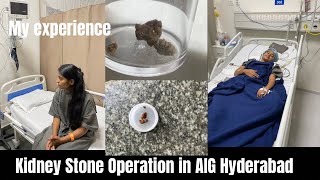 Kidney Stone Operation In AIG Hyderabad Full Details  Riya Chourasia [upl. by Eetsim488]