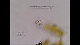 Vorticella microstoma [upl. by Arramas]