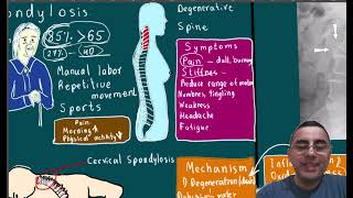 Spondylosis Symptoms causes disease course and treatment [upl. by Haroppizt667]