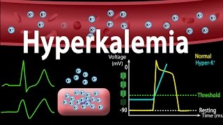 Hyperkalemia Causes Effects on the Heart Pathophysiology Treatment Animation [upl. by Anul]