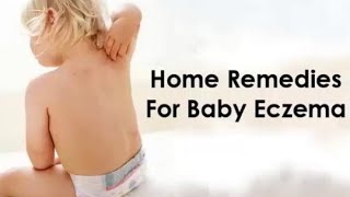 How to Get Rid of Eczema  Home Remedies For Baby Eczema [upl. by Ricoriki]