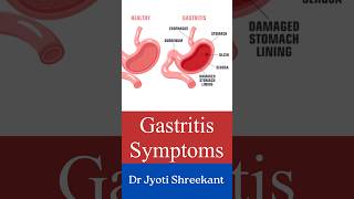 Gastritis symptoms shorts [upl. by Ainafetse]