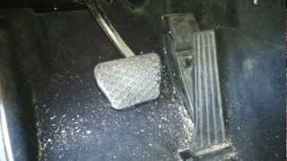 How to remove gas pedal off Bmw E46 330 325 E38 740 E39 M5 540i 530i 525i [upl. by Romona219]