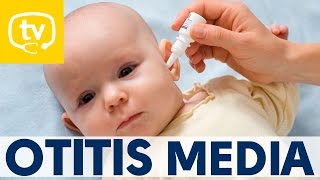 La otitis media ¡todo lo que debes saber [upl. by Robbi]