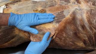 Anterior Abdominal Wall Muscles and the Abdominal Aponeurosis [upl. by Hajin]