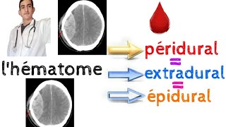 lhématome péridural extradural épidural [upl. by Rydder68]