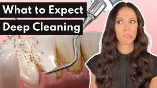 What To Expect From a DEEP Cleaning at the Dentist [upl. by Refennej]