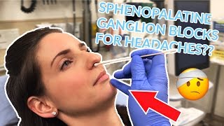 Sphenopalatine Ganglion Block for Treatment of Headaches [upl. by Asilehc]