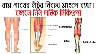 বাম পায়ের হাঁটুর নিচের মাংসে ব্যথা জেনে নিন সমাধান Leg pain treatment [upl. by Ivgnout887]