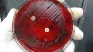 Anaerobic bacteria isolation in Microbiology  Clostridium [upl. by Coleen]