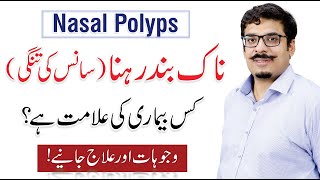 Nasal Polyps  Causes Symptoms amp Treatment  Naak ki haddi  By Dr M Ali Raza [upl. by Imaon]