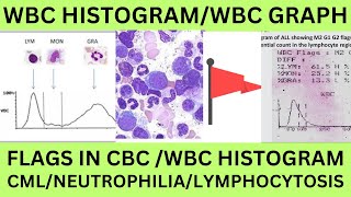 WBC HISTOGRAM FOR STUDENTSWLWUT1T2F1F2 F3AG FLAGS IN WBC HISTOGRAM WBC GRAPH IN CBC PRINT [upl. by Tarabar318]