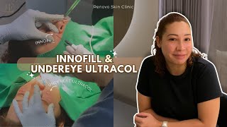 Eyebags Removal in Korea w Innofill amp Undereye UltraCol  Renovo Skin Clinic eyebags skincare [upl. by Nava929]