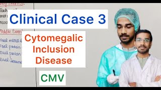 Clinical Case 3  Cytomegalic Inclusion Disease  CMV [upl. by Arvin]