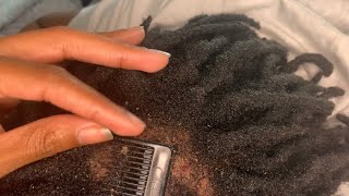 Picking ingrown hair scabs and flakes [upl. by Gowrie329]