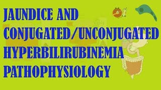 Jaundice and Hyperbilirubinemia Pathophysiology advanced [upl. by Beker]