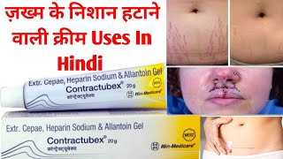 Contractubex 20g Cream Uses in Hindi  Stretch Marks Scar Removal Cream [upl. by Eirameinna145]