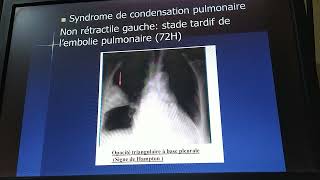 Sémiologie cardiaque et respiratoire  révision 1 cas cliniques examen [upl. by Seabury]