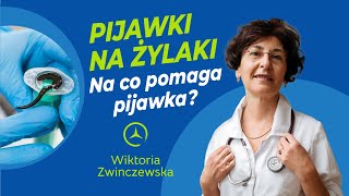 Pijawki Na Żylaki Na Co Pomaga Pijawka Czy Warto Stosować Pijawki Na Żylaki [upl. by Ydnic]