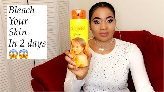 2 days skin bleaching cream stretch marks and dark knuckles my honest review [upl. by Shannah]