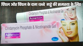 Acnetoin Gel review चेहरे के दाग़ धब्बे एक्ने पिम्पल्स को कैसे रोके acnetoin gel uses hindi acne [upl. by Stetson]