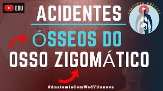 Osso Zigomático ACIDENTES ÓSSEOS Quais são❗❓DESCUBRA AQUI❗ Anatomia Prática [upl. by Ronacin]