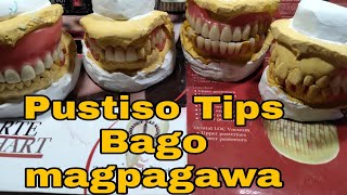 PUSTISO TIPS1 Bago mag pagawa ng Pustiso by DatuAmbasTv [upl. by Kurtis]