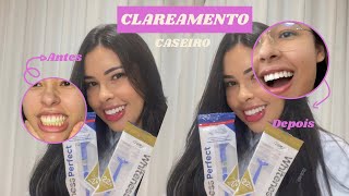 CLAREAMENTO CASEIRO Whiteness Perfect e White Class o melhor produto para clareamento dental [upl. by Eidroj]