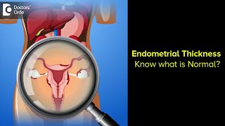 Endometrial Thickness Know what is Normal   Dr H S Chandrika  Doctors Circle [upl. by Silvestro]