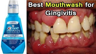 Top 3 Best Mouthwashes for Gingivitis Disease  Periodontal Disease [upl. by Kabab652]