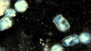 Protozoa Vorticella video [upl. by Sevein]