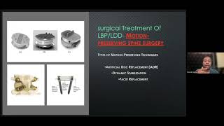 Surgical management of ThoracoLumbar Spine Degenerative Disease [upl. by Nannek]