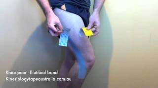 K taping for ITB friction syndrome [upl. by Eissoj]