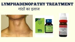 LYMPHADENOPATHY TREATMENTगांठों का ईलाज [upl. by Derron]