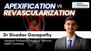 Apexification vs Revascularisation  Dr Sivadas Ganapathy  Online Dentistry  9 PM [upl. by Linzer]