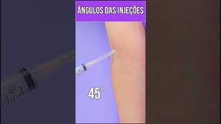 ÂNGULOS DAS INJEÇÕES shorts [upl. by Zaneski]