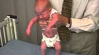 1223 Clinical Pediatrics Hypotonia 6 [upl. by Arabel]