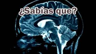 factores de riesgo de enfermedad vascular cerebral [upl. by Novek]