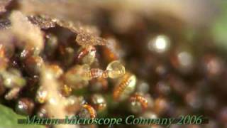 Fern Spores under a microscope [upl. by Eetak]