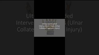 How To Ultrasound Exam of the Medial Collateral Ligament 3D Video [upl. by Ardnosac]