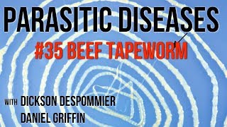 Parasitic Diseases Lectures 35 Beef Tapeworm [upl. by Ennovi]