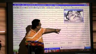 An EEG introduction [upl. by Ramma]