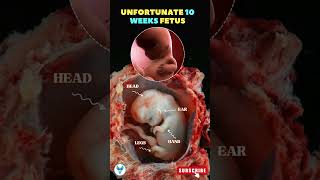 Understanding Fetal Development  A Look at the 10 Week Fetus shorts pregnancy women [upl. by Yttel]