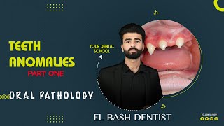 developmental anomalies  teeth anomalies 1 oral pathology عزت شومان [upl. by Anailuig]