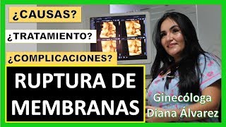 RUPTURA DE MEMBRANAS POR GINECOLOGA DIANA ALVAREZ [upl. by Anitsirhc]