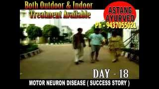 MOTOR NEURON DISEASEAstang Ayurveda [upl. by Ot655]