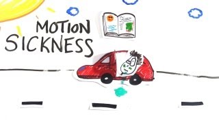 Motion Sickness  What is it [upl. by Annait]