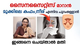 സൈനസൈറ്റിസ് പൂർണ്ണമായി മാറാൻ ഇങ്ങനെ ചെയ്താൽ മതി  Sinusitis Malayalam  Arogyam [upl. by Ainahs]