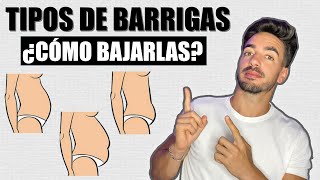 TIPOS de BARRIGAS y CÓMO BAJARLA  Detecta la tuya¡¡ [upl. by Aigneis]